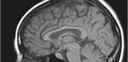 MRI Viewer PC screenshot