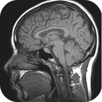 MRI Viewer for PC
