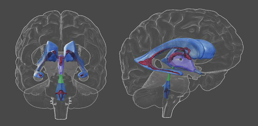 3D Brain PC screenshot